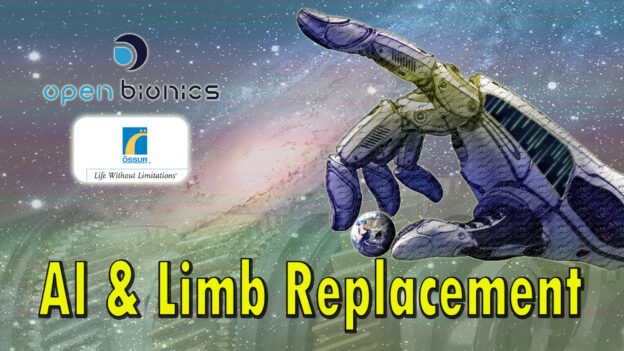 Benefits Of Technology – AI Limb replacement